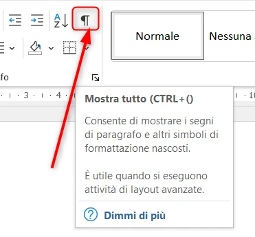 Tasto Mostra tutto